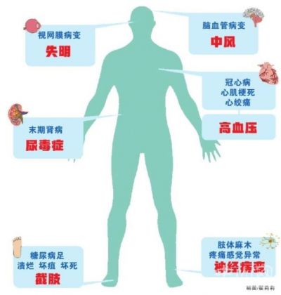 熬夜得糖尿病的概率高吗_熬夜糖尿病会升高吗_经常熬夜久坐患糖尿病几率大