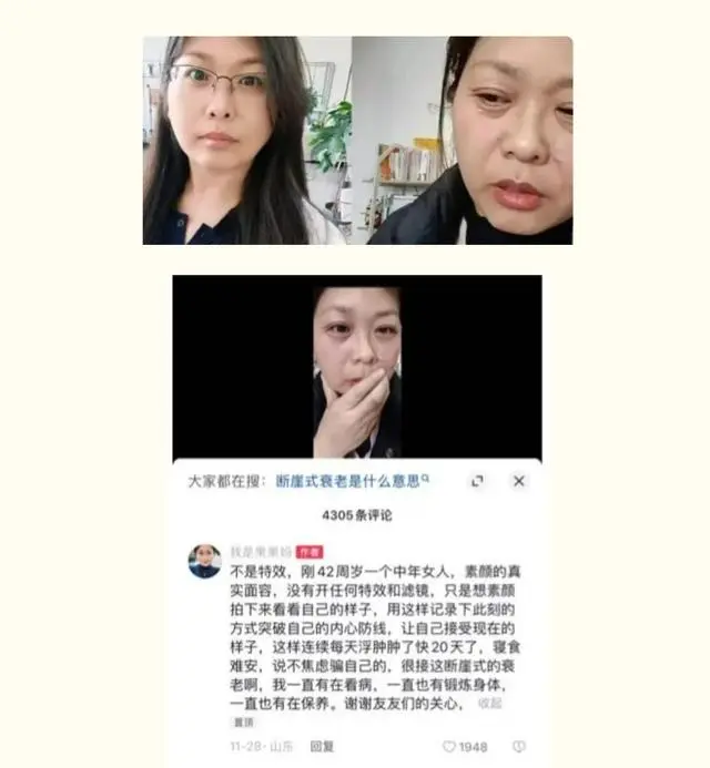 什么叫断崖式衰老_女人断崖式衰老_42岁女子20天断崖式衰老