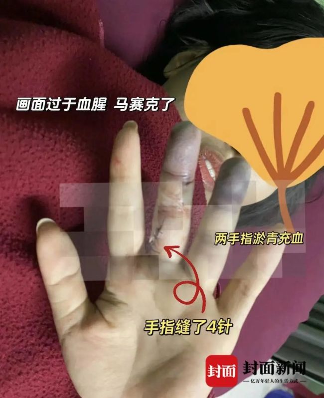 女子巴厘岛打卡恶魔的眼泪险丧命：被几米高的海浪拍倒在礁石上造成多处受伤