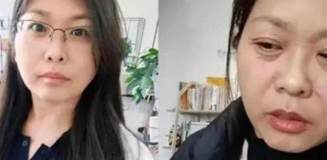 女子自称20天内“老了30多岁” 专家：断崖式衰老