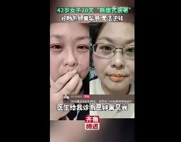 42岁断崖式衰老女子确诊卵巢早衰_女性卵巢衰退_女性卵巢衰竭