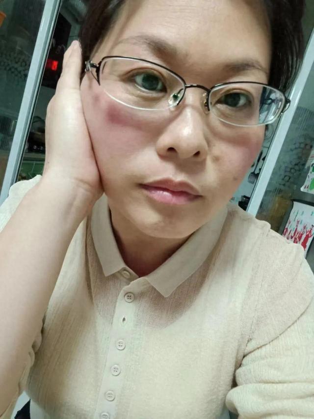 断崖式衰老女子本以为能漂亮过余生_衰老女子离婚了吗_衰老才是女人的至毒