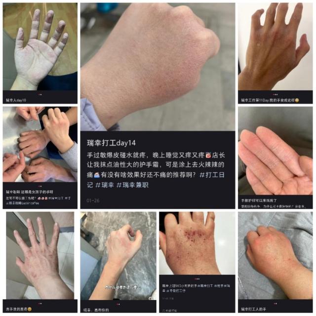 瑞幸被曝洗手流程致员工烂手_瑞幸被曝洗手流程致员工烂手_瑞幸被曝洗手流程致员工烂手