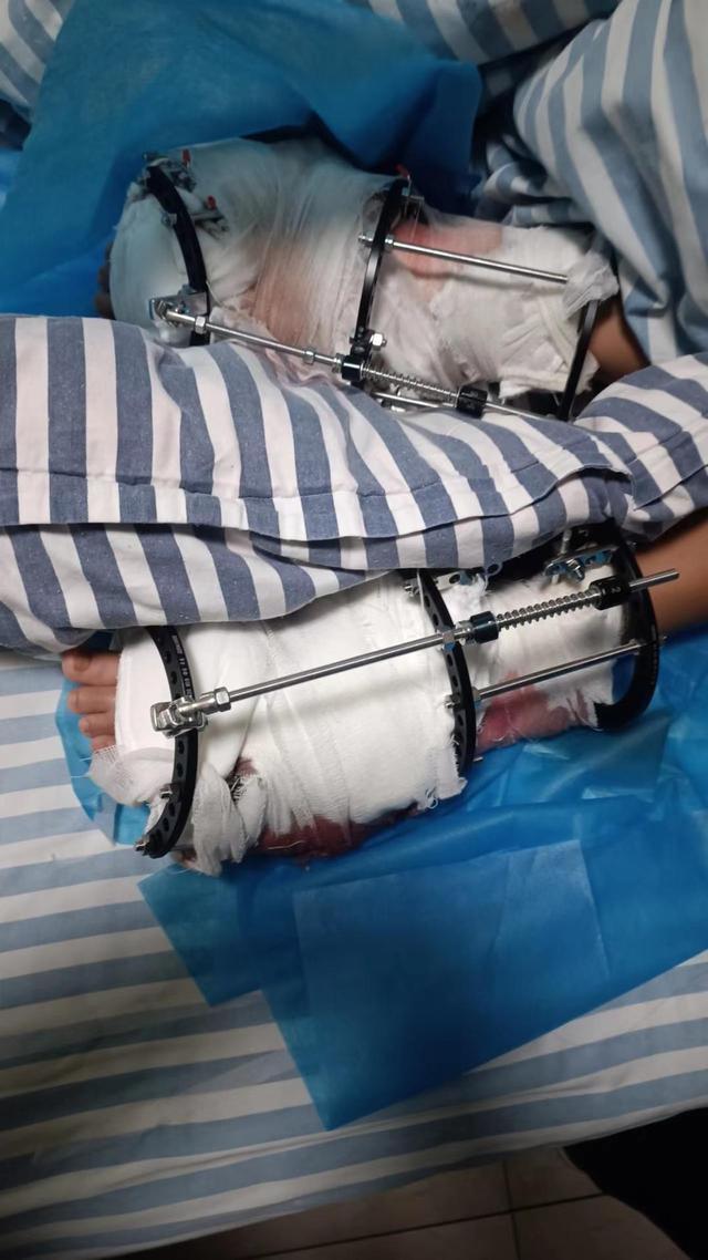 一个残疾男孩的真实人生_残疾的男孩_残疾男孩真实人生小说