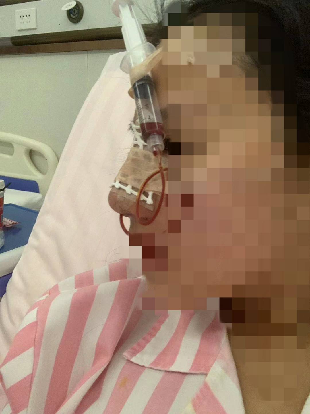 女大学生求职整容_女子整形上班被拒_女大学生入职当天被怂恿整容