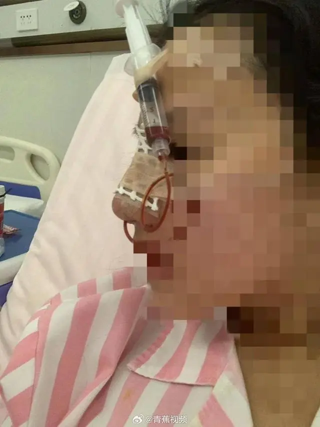 女大学生整容变脸为就业加分_女大学生入职当天被怂恿整容_女孩入职背整容贷今日说法