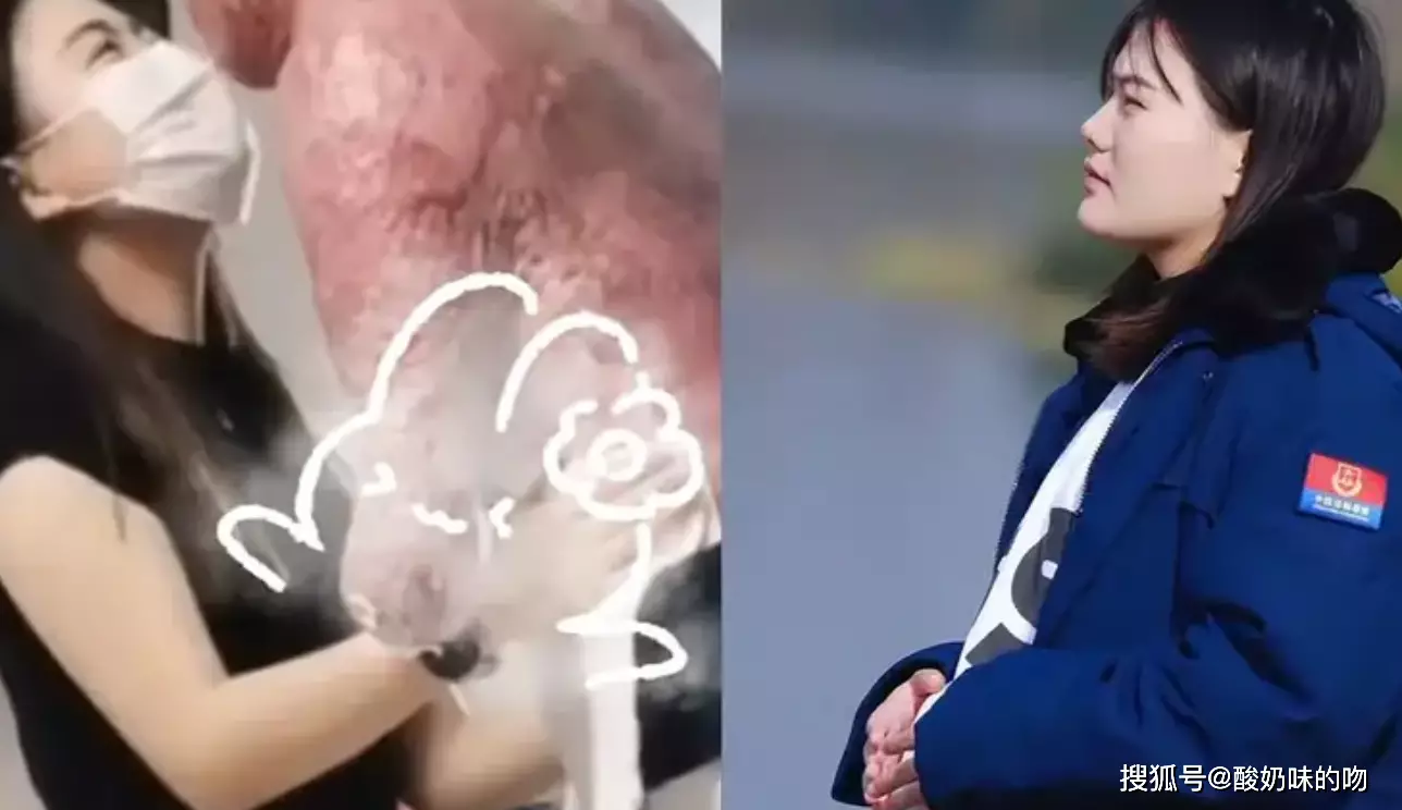 重度烧伤消防员刘攀女友宣布怀孕_湖南孕妇烧伤_90后孕妇重度烧伤