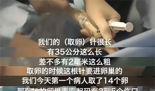 卖卵女孩按学历身高长相被定价 卵子买卖的黑手会伸向大学？