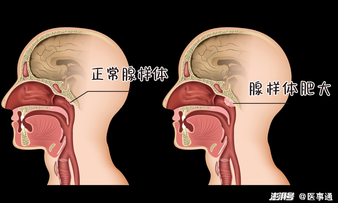 世界睡眠日_睡眠世界纪录_睡眠世界小说