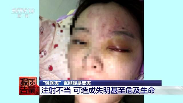 女子丰胸检出骆驼等动物源性成分 医美乱象警示