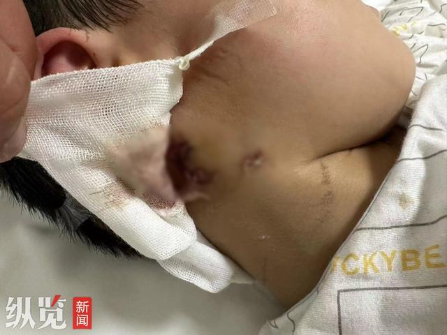 3岁男童被恶犬咬伤离世 母亲发声：还没找到狗主人