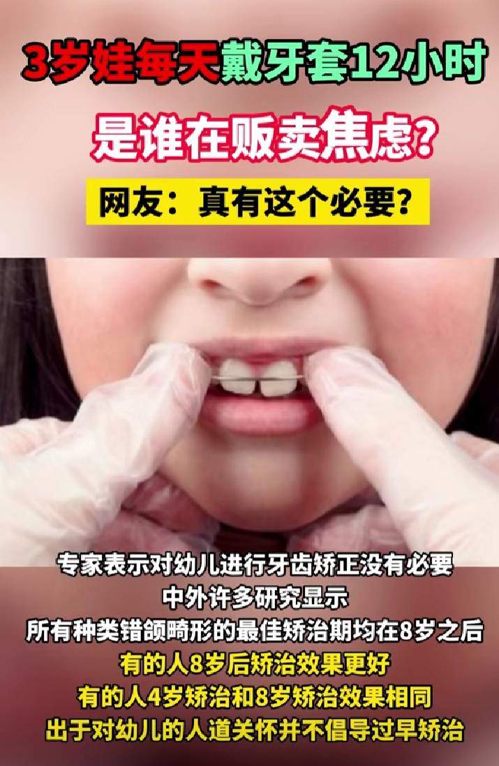 小孩戴牙套会影响长牙吗_戴牙套小朋友_两岁半幼童每天戴12小时牙套