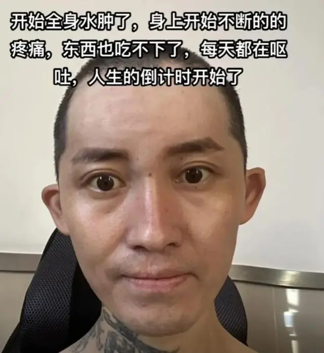 抗癌红人_29岁抗癌网红大飞去世_抗癌离世