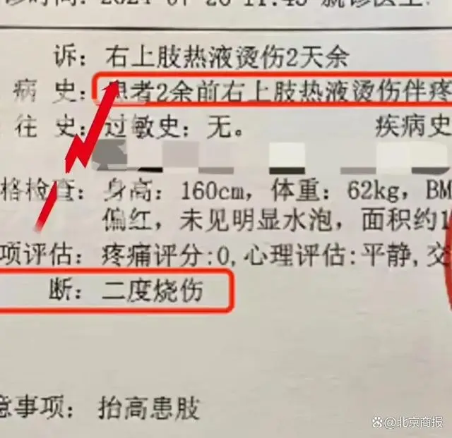 烧伤可以服用美林吗_吃达美乐被烫成二度烧伤_烫烧伤用什么药