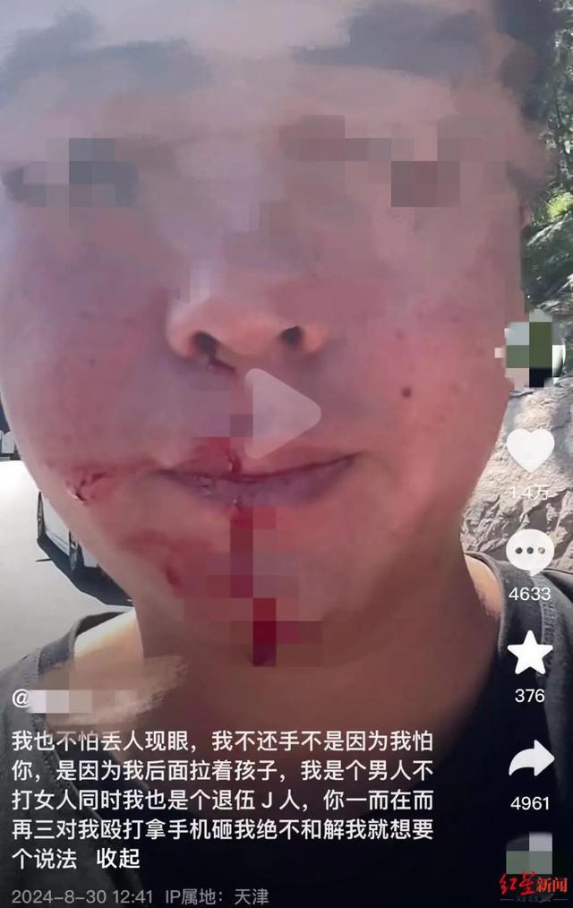 被打伤男子称将起诉逆行路虎女司机