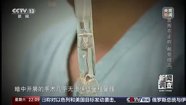 央视曝断骨增高灰色产业链_央视曝断骨增高灰色产业链_央视曝断骨增高灰色产业链