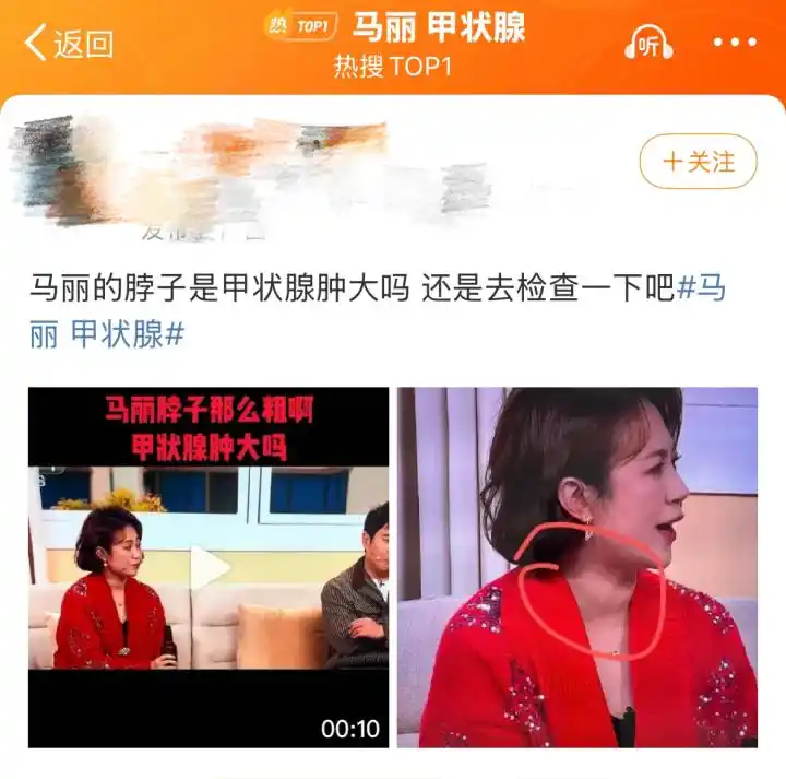 里甲状腺_马越甲状腺_马丽 甲状腺