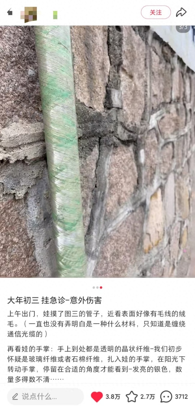 小孩被玻璃纤维扎伤 专家提醒