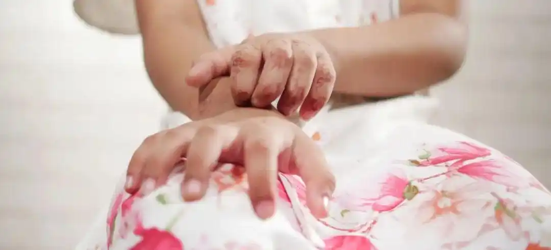 碘伏没有那么“万能”_碘伏是万能的吗_碘伏没有棉签用手擦可以吗