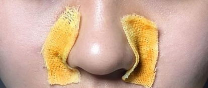 碘伏没有那么“万能”_碘伏是万能的吗_碘伏没有用什么代替