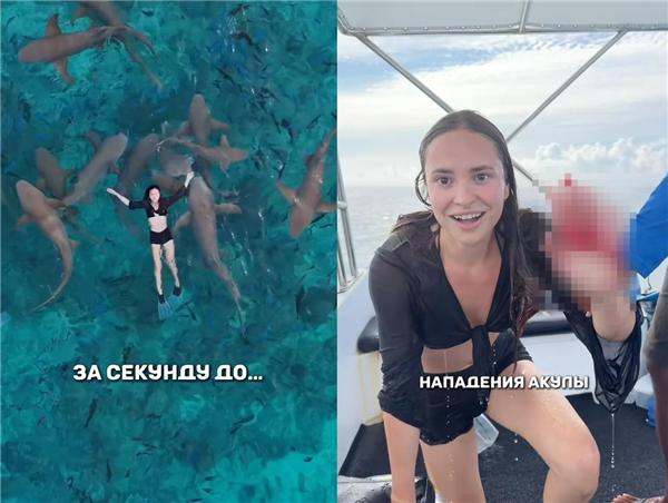 女歌手与鲨鱼共游被咬伤_女子被鲨鱼咬掉手臂_女尸被鲨鱼咬成一半