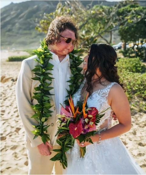 全球首例同时换脸换手男子结婚 爱情超越一切