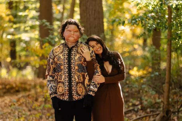 全球首例同时换脸换手男子结婚 爱情超越一切