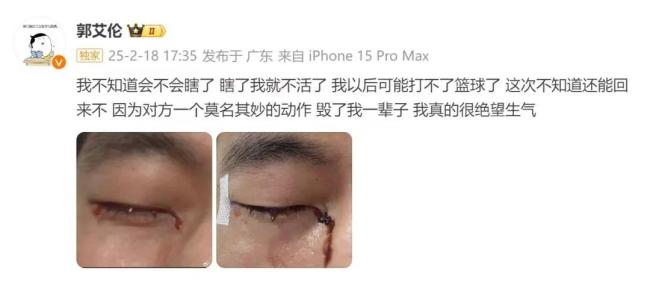 法律角度看郭艾伦右眼受伤 法律责任解析