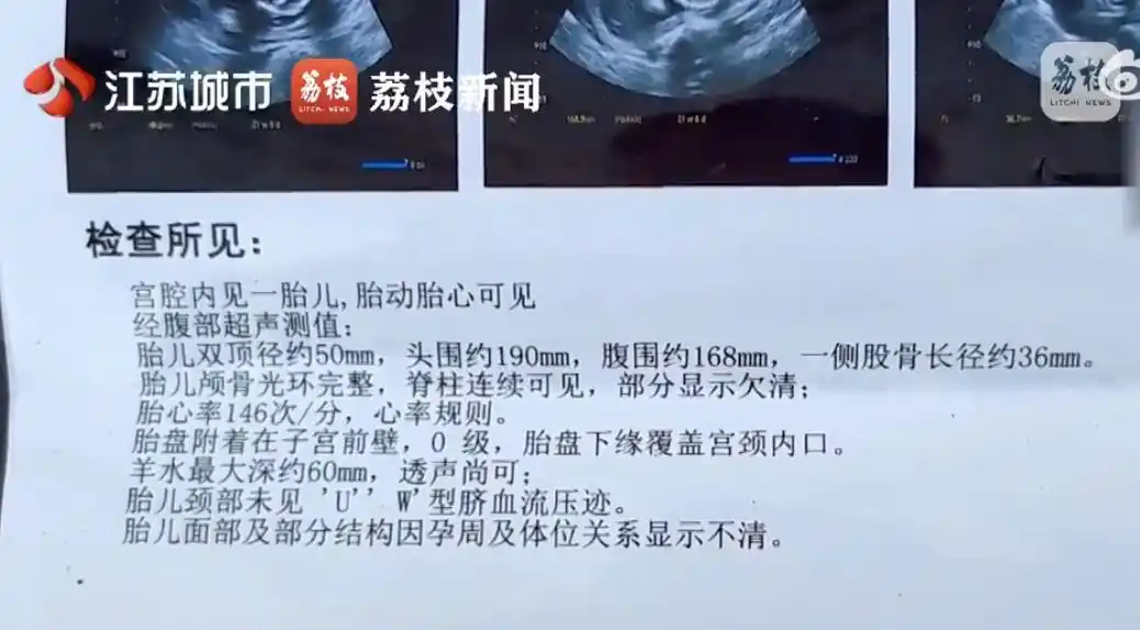 女子怀孕5个月被诊所当妇科病治疗_孕期治疗妇科在线观看_在妇科治疗室上班孕妇有影响吗