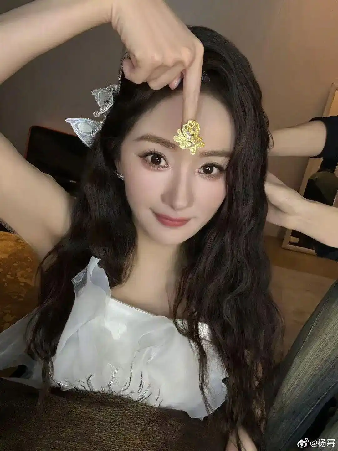 胳膊钙化怎么治疗_胳膊钙化灶_杨幂谈胳膊钙化