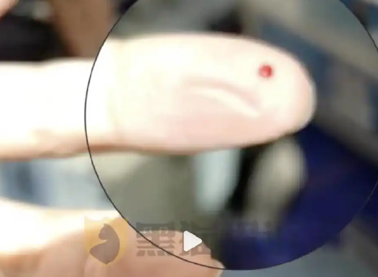 飞机备降乘客索赔_输血针头不小心扎出血了_南航乘客遭废弃针头扎出血索赔遭拒