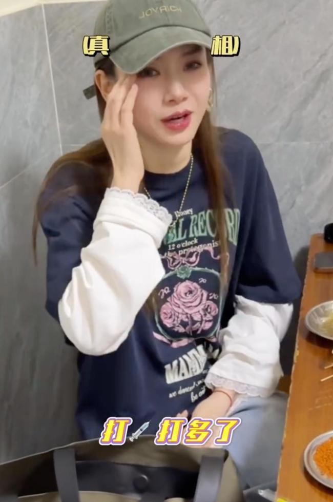 戚薇回应眼睛怎么了 整容风波再起